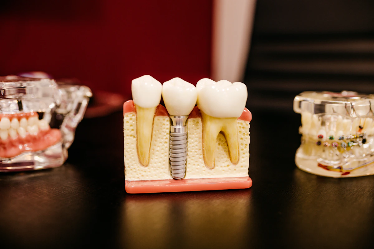 Cosmetic dental procedure in progress